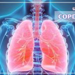 بیماری COPD