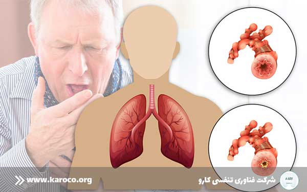  بیماری COPD